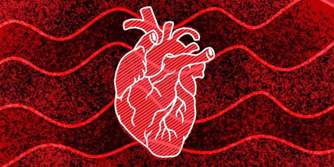 11 oznaki, że może się zdarzyć zatrzymanie akcji serca