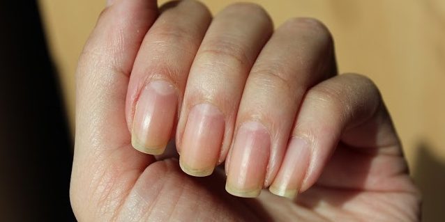 Żółte paznokcie ze względu na czerwony lub pomarańczowy lakier do paznokci