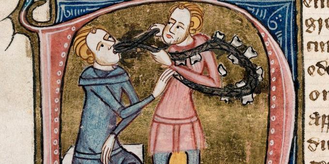 Medycyna średniowieczna: ekstrakcja zęba. Omne Bonum, Londyn, 1360-1375