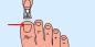 Co powoduje złe strzyżenie paznokcie i jak uniknąć problemów ze zdrowiem